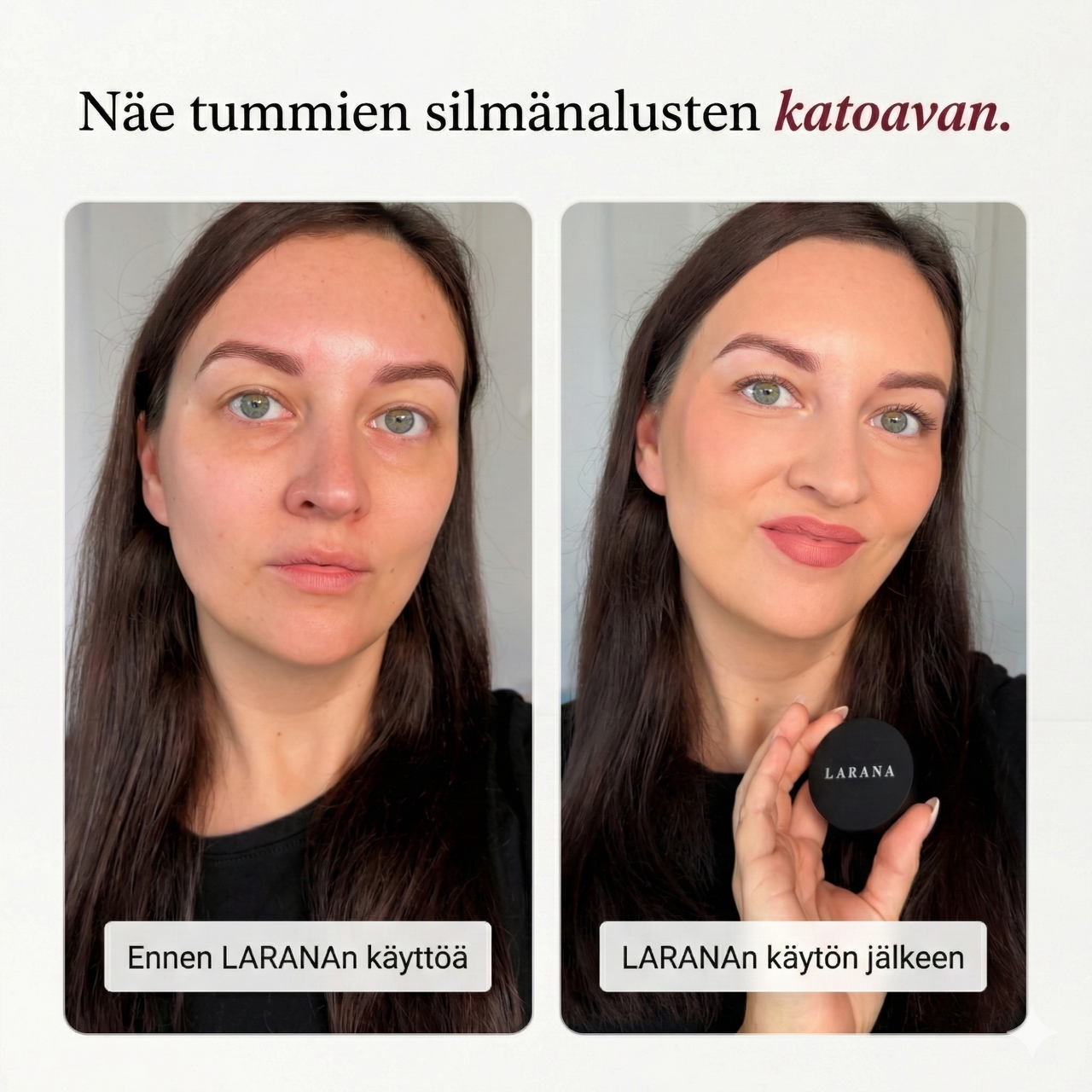 CC-silmänaluskorjaaja